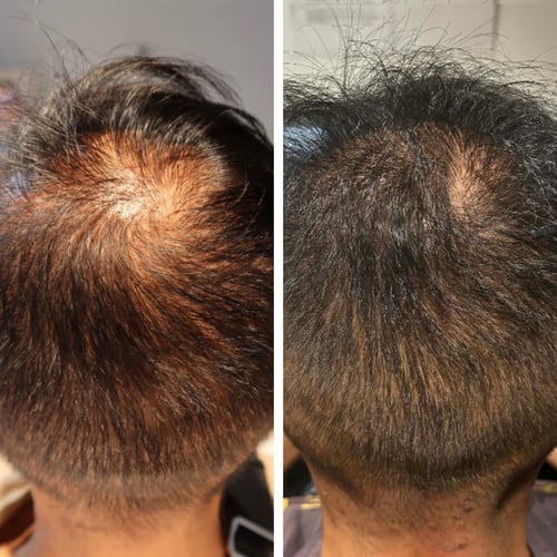 Before-and-After-13