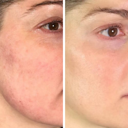 Before-and-After-9 (1)